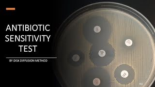 Antibiotic Sensitivity Test by Disc diffusion method Kirby Bauer method amp Stokes method [upl. by Quinton180]