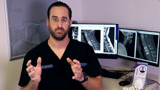 What is a Discectomy  Dr Scott Raffa [upl. by Ocsinarf]