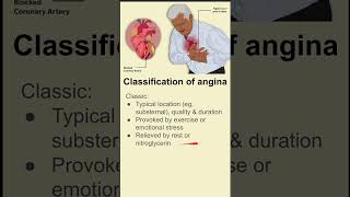 Classification of angina [upl. by Pizor]