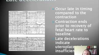 Basic Fetal Heart Rate Monitoring [upl. by Aneled]