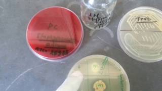 DNase Test Staphylococcus aureuspositive [upl. by Ramedlaw]