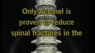 Actonel  Osteoporosis Medication Commercial  60 second Spot 2001 [upl. by Elephus]