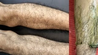 Very heavy growth Leg waxing by Allovera waxHow to do leg Waxing by waxlegwaxingpummybeautyworld [upl. by Baum]