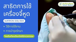 สาธิตการใช้เครื่องจี้หูดไฟฟ้า SURTRON 50D80D [upl. by Schick]