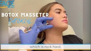 How to Inject Botox to the Masseter Muscles [upl. by Kcirtap]