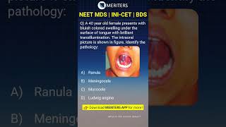 NEET MDS  INICET MDS  PSC  BDS  Most Important Questions neetmds2025 mdsprep [upl. by Trent901]