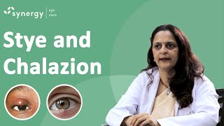 What is a Stye What is a Chalazion Whats are the causes and how can we prevent it [upl. by Deutsch]