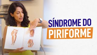 Dor no Ciático ou Síndrome do Piriforme O que fazer [upl. by Ahsote337]