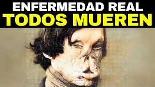 Las 12 Enfermedades Más Terribles De La Historia [upl. by Netsirc270]