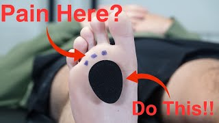 Metatarsal Pad Correct Placement [upl. by Laehcimaj75]