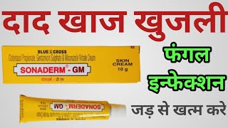 Sonaderm GM Skin Cream Uses  फंगल इनफेक्शन दाद खाज खुजली जड़ से खत्म करे [upl. by Varney747]