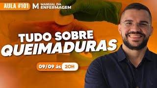 TUDO QUE VOCÊ PRECISA SABER SOBRE QUEIMADURAS  VIDEO AULA 101 [upl. by Fiester]