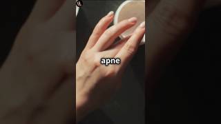 Best Knuckle Whitening Creams Effective Solutions for Dark Knuckles  Top Picks amp Reviews [upl. by Anahsohs]