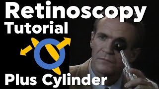 Retinoscopy Plus Cylinder Full Tutorial with Phoropter [upl. by Ocana]