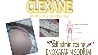 HOW TO INJECT CLEXANE AT HOME  Clexane during my pregnancy [upl. by Esertal]