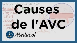 AVC causes  AVC facteurs de risque [upl. by Ronald]