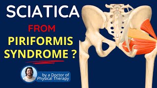 Piriformis Syndrome Sciatica Symptoms amp Back Pain [upl. by Opal]