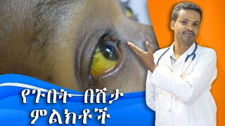 የጉበት በሽታ ህክምና  Hepatitis ABC  ዶር ሰይፈ  Dr Seife [upl. by Elephus]