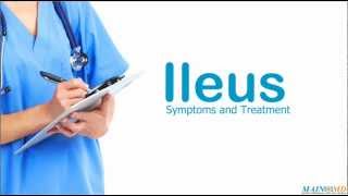 Ileus Symptoms and Treatment [upl. by Pinter]