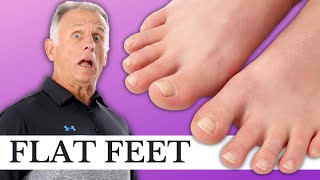 3 Critical Exercises for Pronated Flat Feet Causing Foot amp Leg Pain [upl. by Japheth]