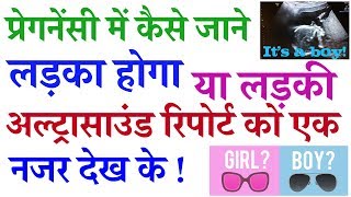 Baby in womb Gender Prediction by heart rate in hindi [upl. by Zigmund]