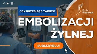 EMBOLIZACJA ŻYLNA  jak przebiega zabieg [upl. by Platto47]