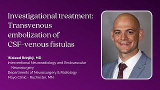 Dr Waleed Brinjikji—Investigational treatment Transvenous embolization of CSFvenous fistulas [upl. by Downall]