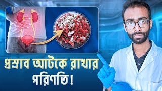 দীর্ঘ সময় প্রস্রাব আটকে রাখলে শরীরে যা ঘটে  Holding Pee Risks and Effects  Sabbir Ahmed [upl. by Bradeord7]