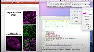 ImageJ Macro Cell Counter Instructional Video [upl. by Whipple548]