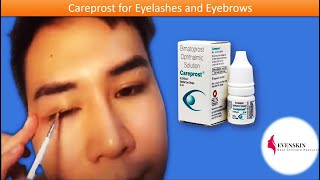 Buy Careprost for Eyelashes and Eyebrows  See Description [upl. by Sass573]