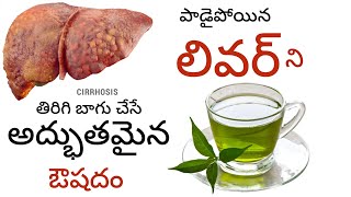 Cleanse Your Liver Naturally l jaundice jaundicetreatment phyllanthus hepatitis livercirrhosis [upl. by Anabel37]