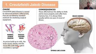 Types of Prions Diseases  Prions diseases in Animals and Human  Part 02 [upl. by Germin5]