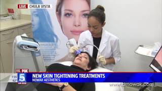 New Skin Tightening Treatment Exilis Ultra Face [upl. by Assiran]