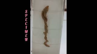 Balanoglossus 🪱  Hemichordata  NonChordata  Specimen [upl. by Sorcha]