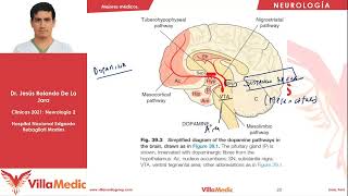 SINDROME DE PARKINSON Neurología Desórdenes del movimiento  Neurología  Villamedic Clínicas [upl. by Eannyl]