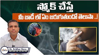 How Smoking Affects Your Body  Side Effects of Smoking Cigarettes in Telugu  Dr Devu [upl. by Cappello938]