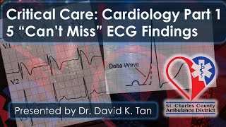 Cardiology for Critical Care Part 1  ECG [upl. by Clarey]