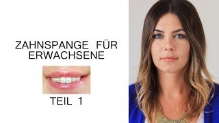 Zahnspange für Erwachsene  Der erste Schritt [upl. by Barden488]