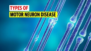 Types of Motor neuron disease [upl. by Hedberg]