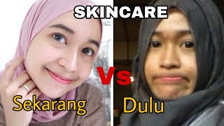 MY SKINCARE ROUTINE quotDULUquot VS quotSEKARANG UNTUK KULIT BERMINYAK BERJERAWAT [upl. by Lauter]