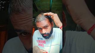 Day 21 My oil testing for hair regrowth hairfall hairlosstreatment hairgrowth homeremedies [upl. by Idnam]