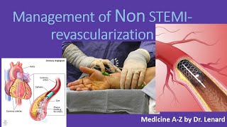 Management of Non STEMI Timing for PCI Anticoagulation antiplatelet UN VS NSTEMI [upl. by Aicre]