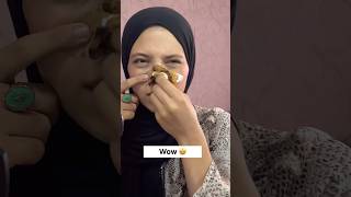 Remove Blackheads In Just 2minutes  Get Rid Of Blackheads amp Whiteheads shorts [upl. by Einehpets338]