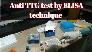 Procedure of Anti TTG tissue transglutaminase test IgG amp IgA by Elisa Technique [upl. by Idnahc]