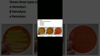 Haemolysis on streptococci and its types microbiology biology subscribe 👍😍🧫🔬 [upl. by Lavella533]