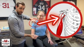 Biceps Tendinopathy  What Physical Therapists Need to Know [upl. by Airasor]