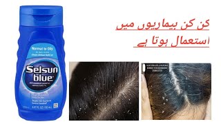 selsun blue shampoo uses complete review [upl. by Nesiaj]