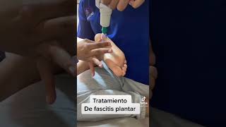 👉Tratamiento para fascitis plantar 🦶 [upl. by Belda]