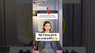 Nancy Tyagi answer about face surgery on Instagram [upl. by Ylak]