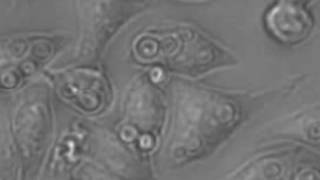 Cryptococcus neoformans migrating between macrophages [upl. by Kciredec]